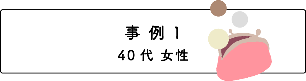 事例1/40代 女性